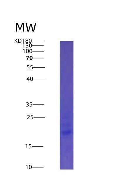 Human IL25 (Interleukin-25) - Recombinant Protein