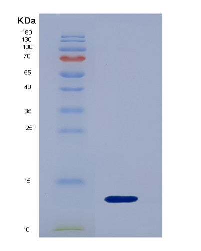 Human IL17F (Interleukin-17F) - Recombinant Protein