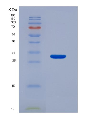 Human IL22RA2 (Interleukin-22 Receptor Subunit Alpha-2) - Recombinant Protein