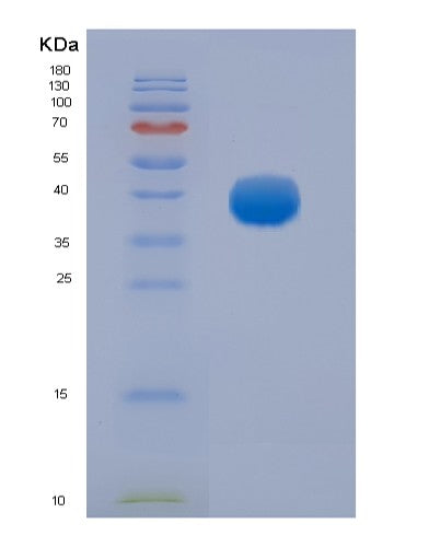 Human FCGR3A (Low Affinity Immunoglobulin Gamma Fc Region Receptor Iii-A) - Recombinant Protein
