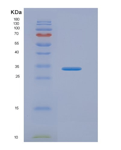 Human ASPA (Aspartoacylase) - Recombinant Protein