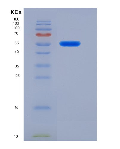 Human ITGB1 (Integrin Beta-1) - Recombinant Protein