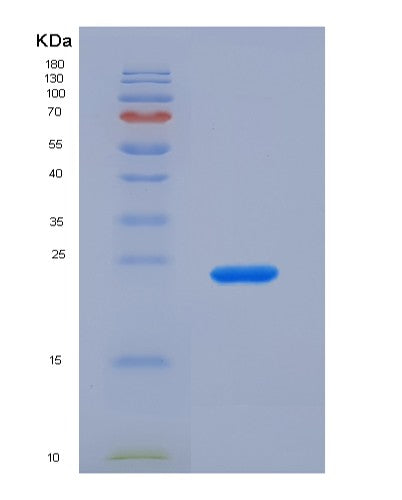 Human CRYAB (Alpha-Crystallin B Chain) - Recombinant Protein
