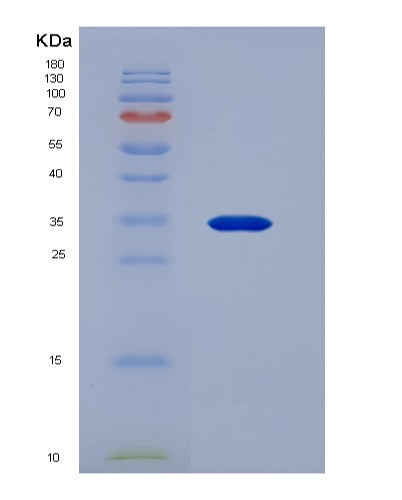 Human Thymopoietin (TMPO) - Recombinant Protein