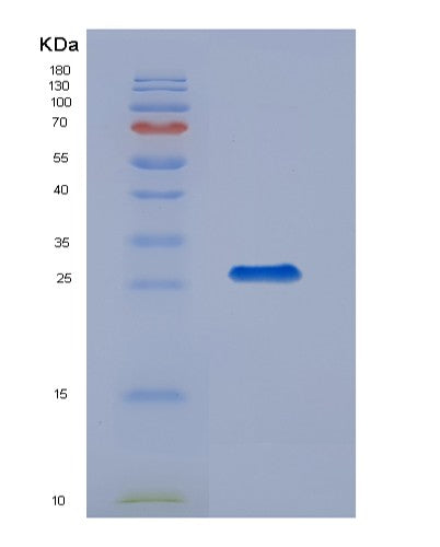 Human SNAP23 (Synaptosomal-Associated Protein 23) - Recombinant Protein
