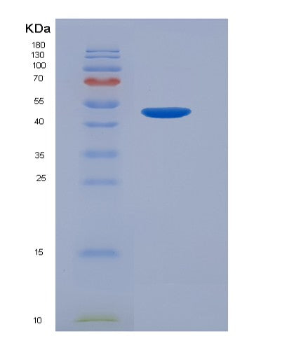 Human LGALS9 (Galectin-9) - Recombinant Protein