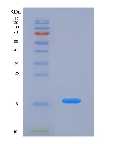 Human AGRP (Agouti-Related Protein) - Recombinant Protein