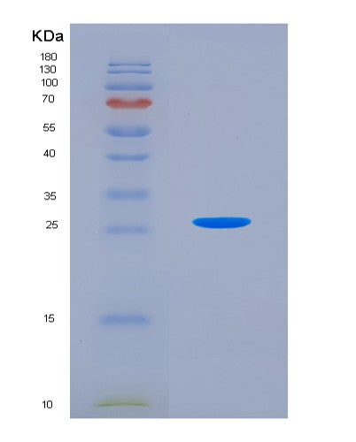 Human CLIC1 (Chloride Intracellular Channel Protein 1) - Recombinant Protein