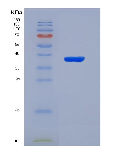 Human EEF2K (Eukaryotic Elongation Factor 2 Kinase) - Recombinant Protein