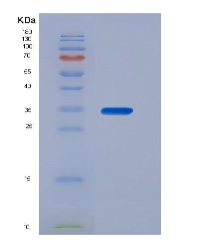 Human BIN1 (Myc Box-Dependent-Interacting Protein 1) - Recombinant Protein