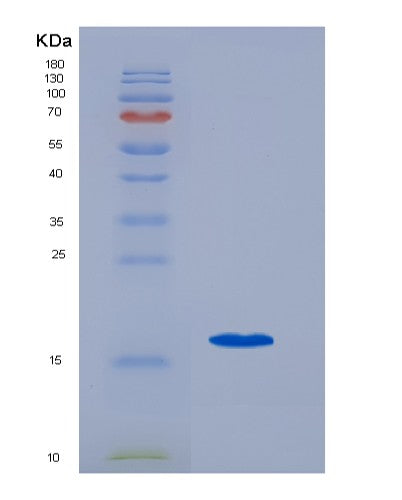 Human CCL21 (C-C Motif Chemokine 21) - Recombinant Protein