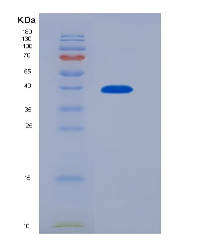Human CCL22 (C-C Motif Chemokine 22) - Recombinant Protein