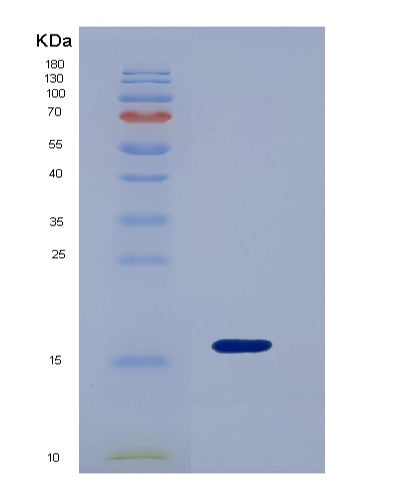 Mouse Lgals9 (Galectin-9) - Recombinant Protein