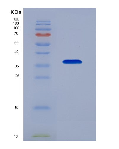 Human TOR1A (Torsin-1A) - Recombinant Protein