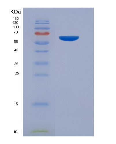 Human CFLAR (Casp8 And Fadd-Like Apoptosis Regulator) - Recombinant Protein