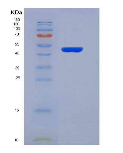 Human SPINT2 (Kunitz-Type Protease Inhibitor 2) - Recombinant Protein