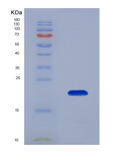 Human BCL2L11 (Bcl-2-Like Protein 11) - Recombinant Protein