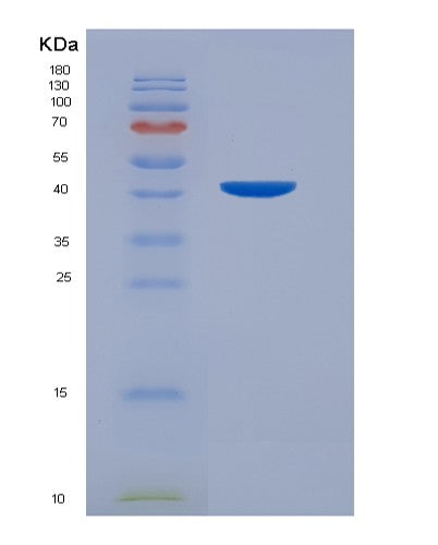 Human NARS1 (Asparagine--Trna Ligase, Cytoplasmic) - Recombinant Protein