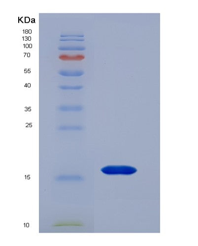 Human CXCL13 (C-X-C Motif Chemokine 13) - Recombinant Protein