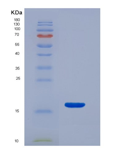Mouse Snca (Alpha-Synuclein) - Recombinant Protein