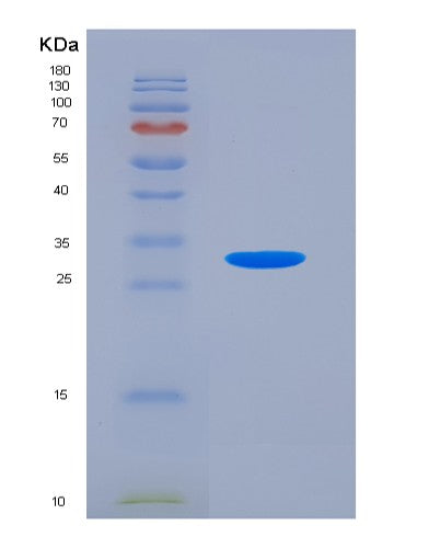 Human PREP (Prolyl Endopeptidase) - Recombinant Protein