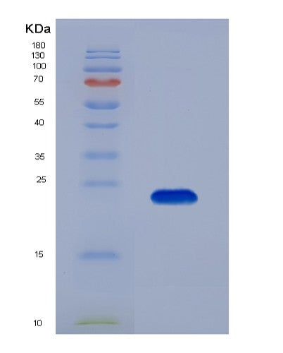 Human GREM1 (Gremlin-1) - Recombinant Protein