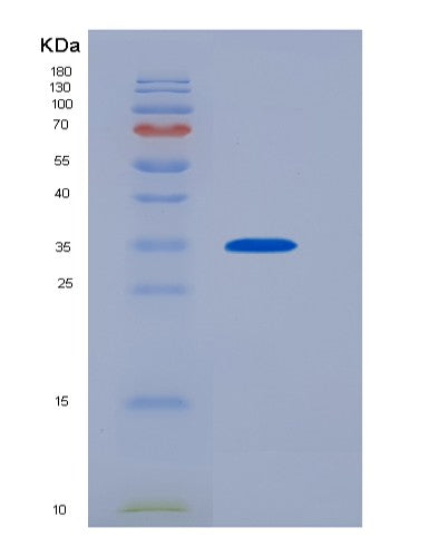 Human JAK2 (Tyrosine-Protein Kinase Jak2) - Recombinant Protein