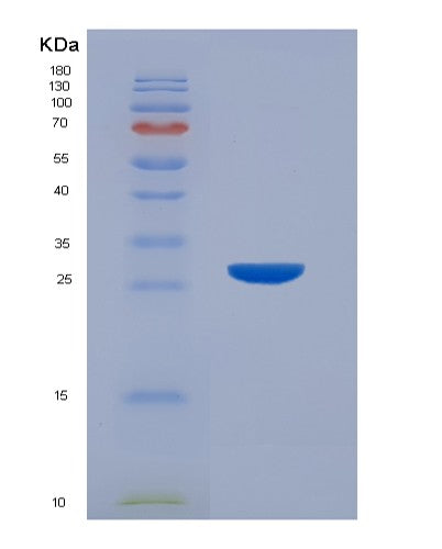 Human HPGDS (Hematopoietic Prostaglandin D Synthase) - Recombinant Protein