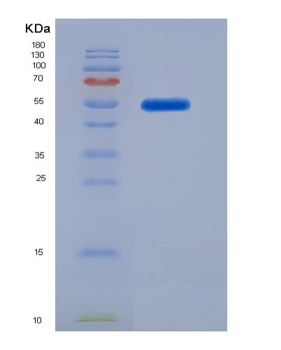 Human GAS7 (Growth Arrest-Specific Protein 7) - Recombinant Protein