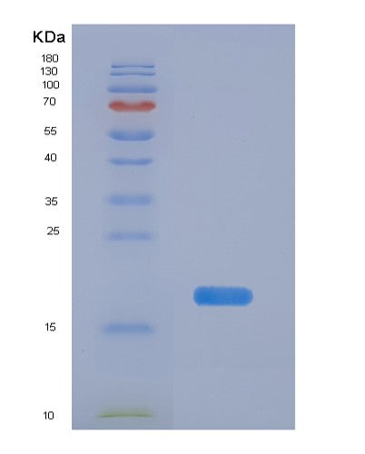 Human PFDN1 (Prefoldin Subunit 1) - Recombinant Protein