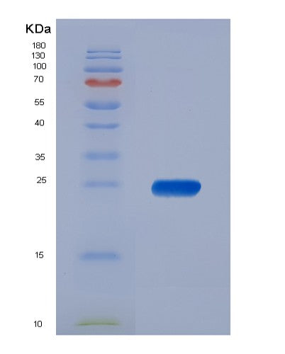 Human PPP1R11 (E3 Ubiquitin-Protein Ligase Ppp1R11) - Recombinant Protein