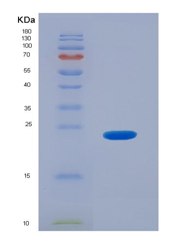 Human FCGR3B (Low Affinity Immunoglobulin Gamma Fc Region Receptor Iii-B) - Recombinant Protein