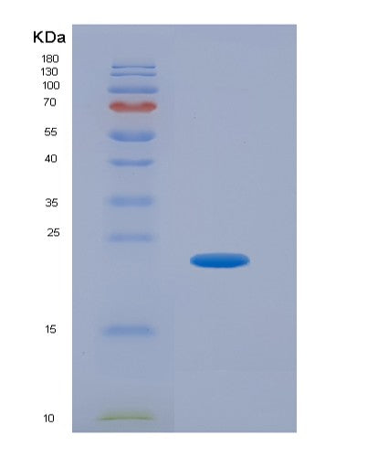 Human GADD45B (Growth Arrest And Dna Damage-Inducible Protein Gadd45 Beta) - Recombinant Protein