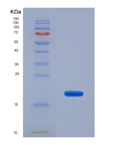 Human TBCA (Tubulin-Specific Chaperone A) - Recombinant Protein