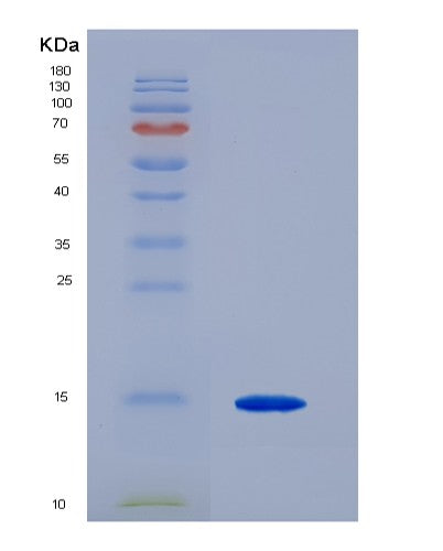 Human VAMP4 (Vesicle-Associated Membrane Protein 4) - Recombinant Protein