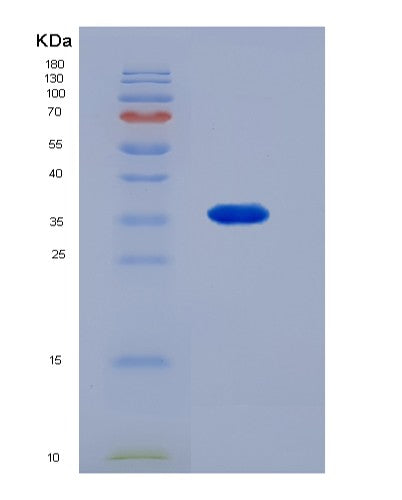 Human CS (Citrate Synthase, Mitochondrial) - Recombinant Protein