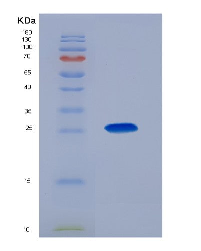 Human PSIP1 (Pc4 And Sfrs1-Interacting Protein) - Recombinant Protein