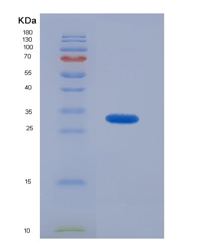 Human GPC4 (Glypican-4) - Recombinant Protein