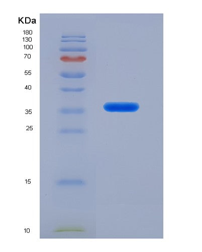 Human RNASEH2A (Ribonuclease H2 Subunit A) - Recombinant Protein