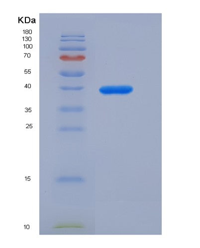 Human CBR3 (Carbonyl Reductase [Nadph] 3) - Recombinant Protein