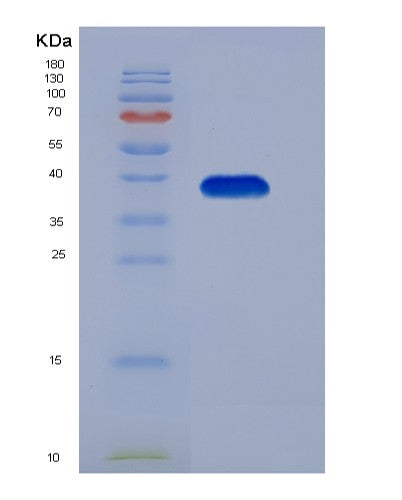 Human MMP23B (Matrix Metalloproteinase-23) - Recombinant Protein