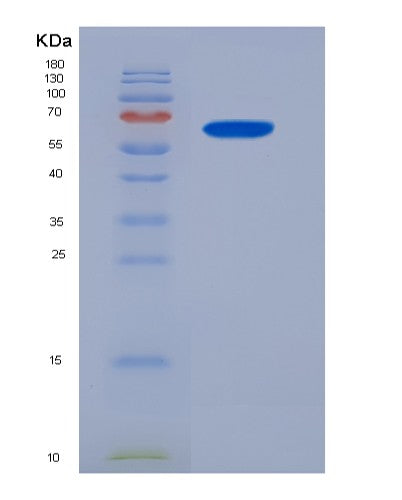 Human BEST1 (Bestrophin-1) - Recombinant Protein