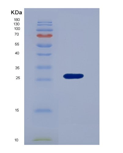 Human DDAH1 (N(G),N(G)-Dimethylarginine Dimethylaminohydrolase 1) - Recombinant Protein