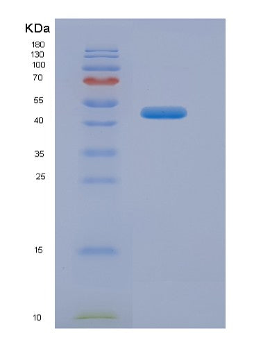 Human SNUPN (Snurportin-1) - Recombinant Protein