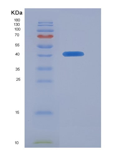 Human ZWINT (Outer Kinetochore Knl1 Complex Subunit Zwint) - Recombinant Protein
