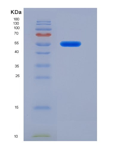 Human FARS2 (Phenylalanine--Trna Ligase, Mitochondrial) - Recombinant Protein