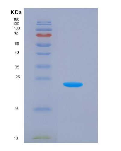 Human LYPLA2 (Acyl-Protein Thioesterase 2) - Recombinant Protein