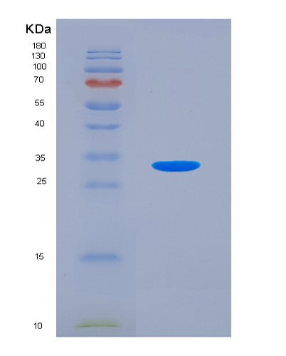 Human GDF11 (Growth/Differentiation Factor 11) - Recombinant Protein