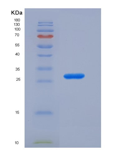 Human APOM (Apolipoprotein M) - Recombinant Protein