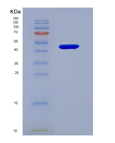 Human SERPINC1 (Antithrombin-Iii) - Recombinant Protein
